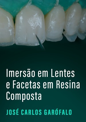 Cover for Imersāo em Lentes e Facetas em Resina Composta