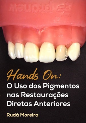 Cover for Hands On: O Uso dos Pigmentos nas Restaurações Diretas Anteriores