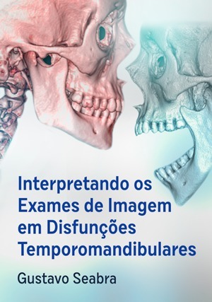 Cover for Interpretando os Exames de Imagem em Disfunções Temporomandibulares