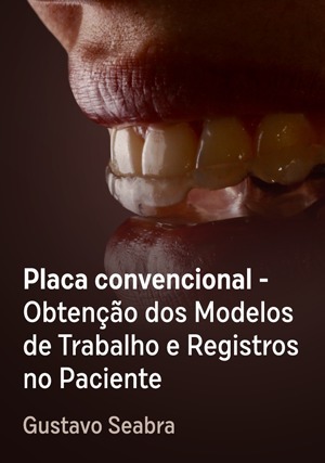 Cover for Placa convencional - Obtenção dos Modelos de Trabalho e Registros no Paciente