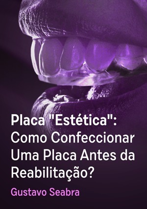 Cover for Placa "Estética": Como Confeccionar Uma Placa Antes da Reabilitação?