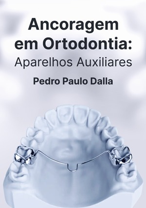 Cover for Ancoragem em Ortodontia: Aparelhos Auxiliares
