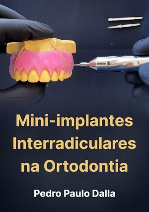 Cover for Ortodontia e os Mini-implantes Interradiculares