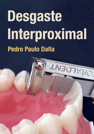 Cover for Desgaste Interproximal