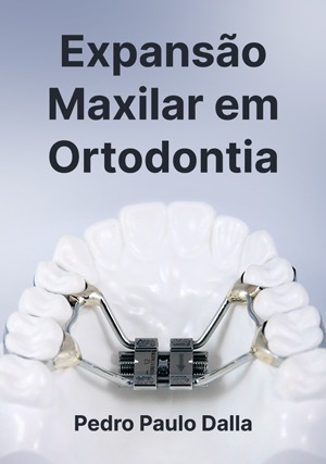 Cover for Expansão Maxilar em Ortodontia