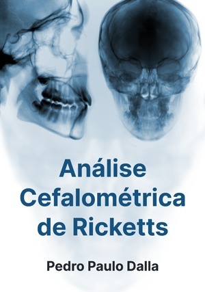 Cover for Análise Cefalométrica de Ricketts