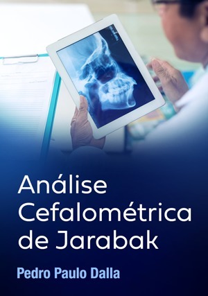 Cover for Análise Cefalométrica de Jarabak