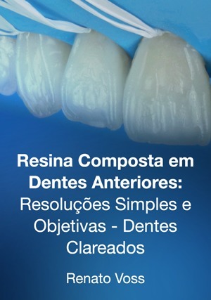 Cover for Resina Composta em Dentes Anteriores: Resoluções Simples e Objetivas - Dentes Clareados