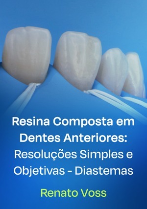 Cover for Resina Composta em Dentes Anteriores: Resoluções Simples e Objetivas - Diastemas