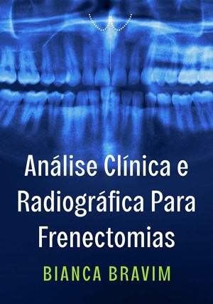 Cover for Análise Clínica e Radiográfica Para Frenectomias