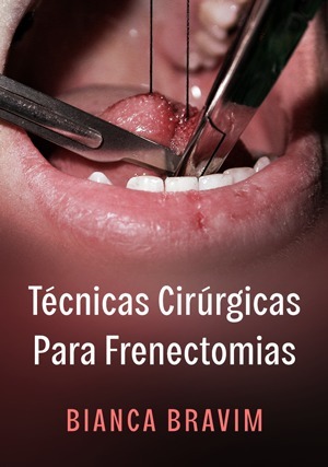 Cover for Técnicas Cirúrgicas Para Frenectomias