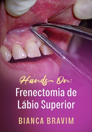 Cover for Hands On: Frenectomia de Lábio Superior