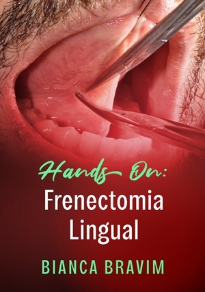 Cover for Hands On: Frenectomia Lingual
