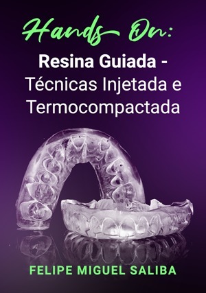 Cover for Hands on: Resina Guiada - Técnicas Injetada e Termocompactada