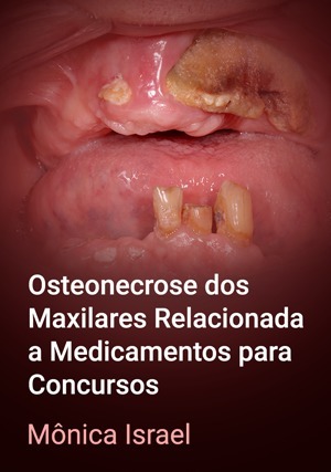Cover for Osteonecrose dos Maxilares Relacionada a Medicamentos Para Concursos