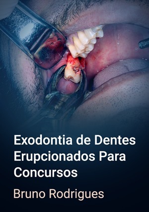 Cover for Exodontia de Dentes Erupcionados Para Concursos