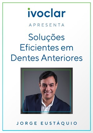 Cover for Ivoclar Apresenta: Soluções eficientes em Dentes Anteriores