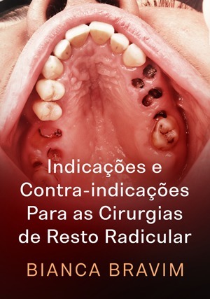 Cover for Indicações e Contra-indicações Para as Cirurgias de Resto Radicular