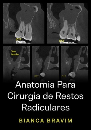 Cover for Anatomia Para Cirurgia de Restos Radiculares