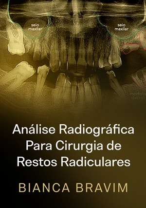 Cover for Análise Radiográfica Para Cirurgia de Restos Radiculares