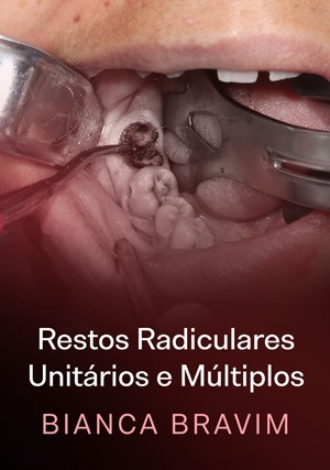 Cover for Restos Radiculares Unitários e Múltiplos