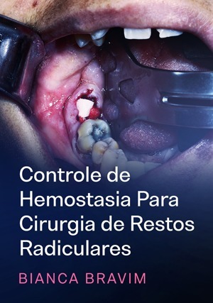 Cover for Controle de Hemostasia Para Cirurgia de Restos Radiculares