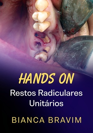 Cover for Hands On: Restos Radiculares Unitários
