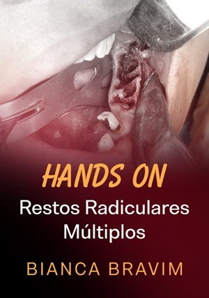 Cover for Hands On: Restos Radiculares Múltiplos