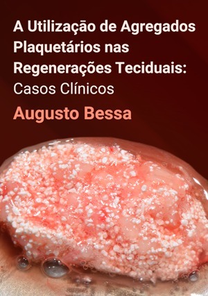 Cover for A Utilizaçāo de Agregados Plaquetários nas Regenerações Teciduais: Casos Clínicos