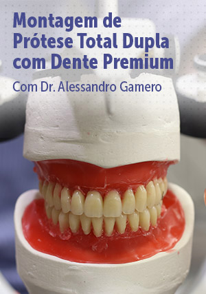 Cover for Montagem de Prótese Total Dupla com Dente Premium
