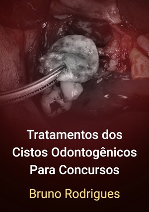 Cover for Tratamentos dos Cistos Odontogênicos Para Concursos