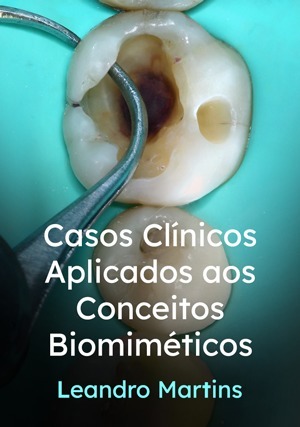 Cover for Casos Clínicos Aplicados aos Conceitos Biomiméticos