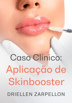 Cover for Caso Clínico: Aplicação de Skinbooster