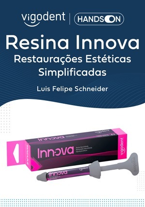 Cover for Hands On: Resina Innova Restaurações Estéticas Simplificadas