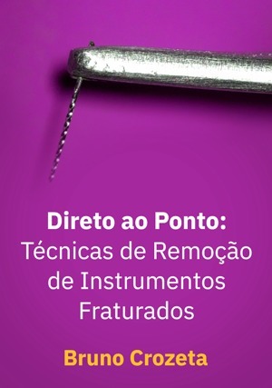 Cover for Direto ao Ponto: Técnicas de Remoção de Instrumentos Fraturados
