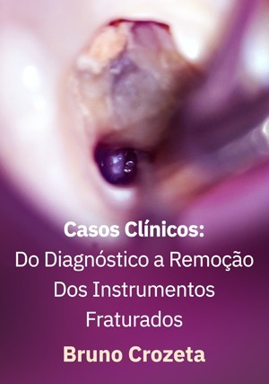 Cover for Casos Clínicos: Do Diagnóstico a Remoção Dos Instrumentos Fraturados