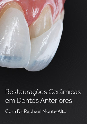 Cover for Restaurações Cerâmicas em Dentes Anteriores