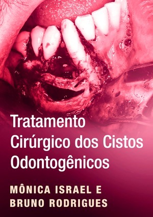 Cover for Tratamento Cirúrgico dos Cistos Odontogênicos