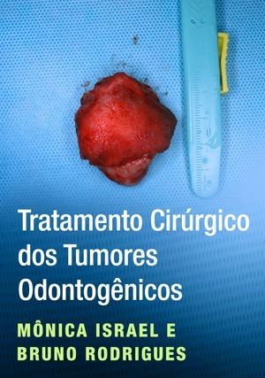 Cover for Tratamento Cirúrgico dos Tumores Odontogênicos