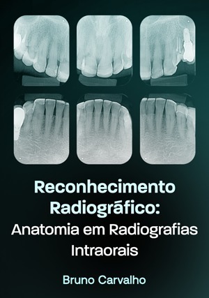 Cover for Reconhecimento Radiográfico: Anatomia em Radiografias Intraorais