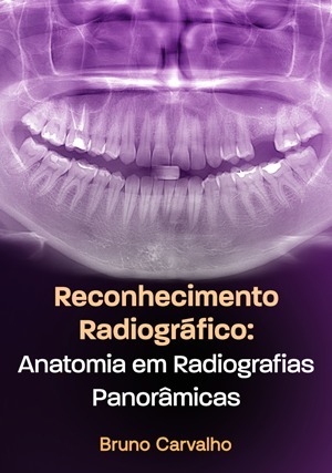 Cover for Reconhecimento Radiográfico: Anatomia em Radiografias Panorâmicas