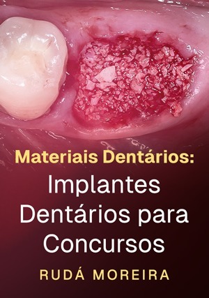 Cover for Materiais Dentários: Implantes Dentários para Concursos