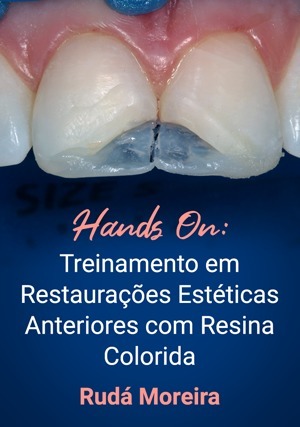 Cover for Hands On: Treinamento em Restaurações Estéticas Anteriores com Resina Colorida