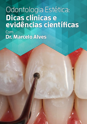 Cover for Odontologia Estética: Dicas Clínicas e Evidências Científicas