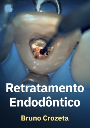 Cover for Retratamento Endodôntico