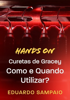 Cover for Hands-On: Curetas de Gracey. Como e Quando Utilizar?