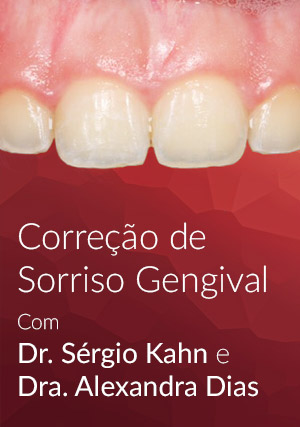 Cover for Correção de Sorriso Gengival