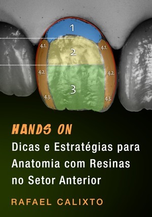 Cover for Hands on: Dicas e Estratégias para Anatomia com Resinas no Setor Anterior