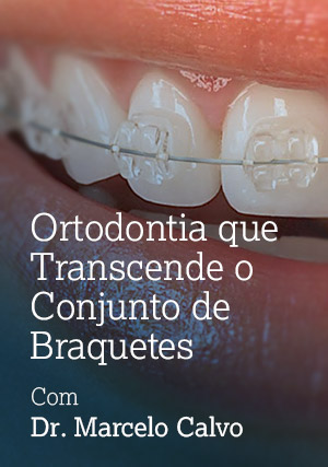 Cover for Um Conceito em Ortodontia que transcende o Conjunto de Braquetes