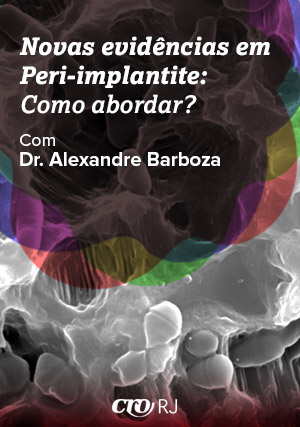 Cover for Novas Evidências em Peri-implante Como Abordar?